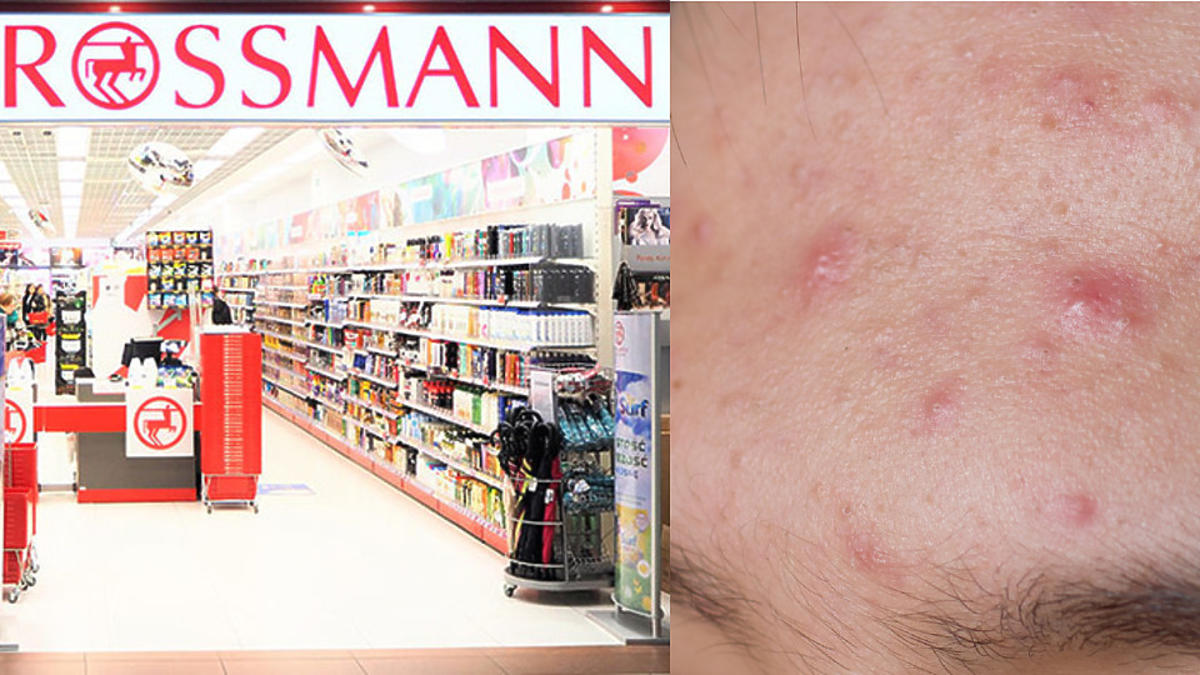 iwostin rossmann