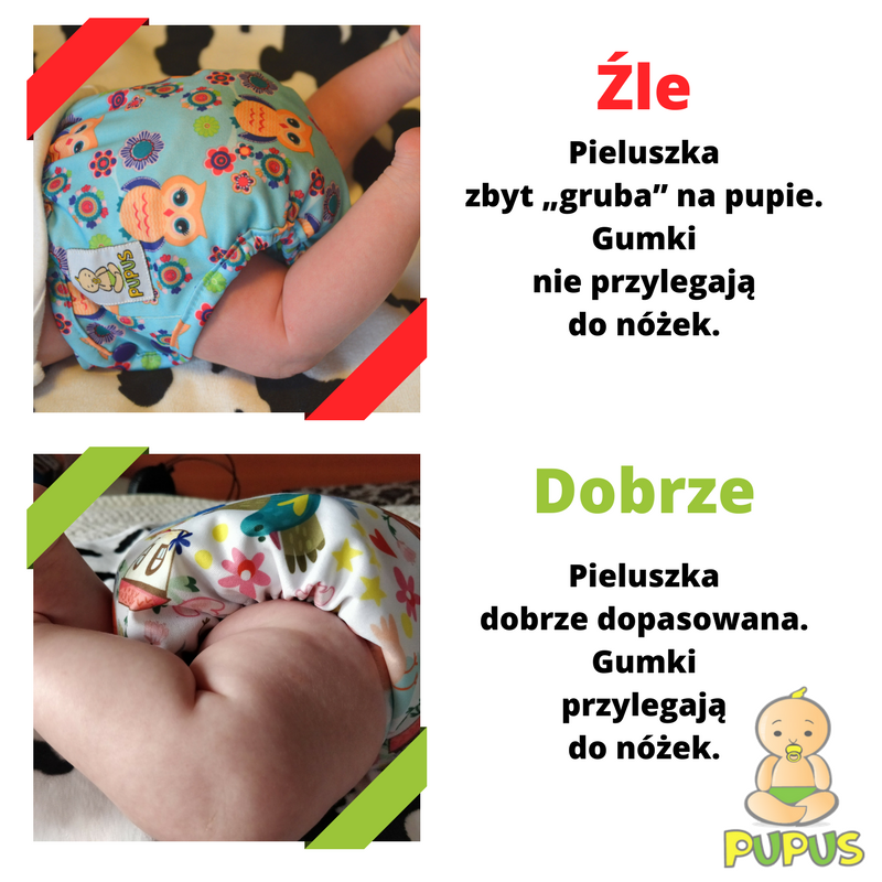 czy wkladac pieluchy miedzy nozki niemowlecia