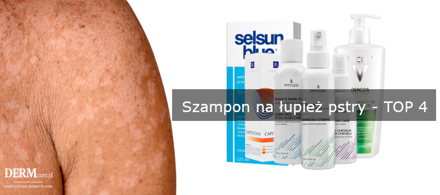 jaki szampon na łupiez pstry