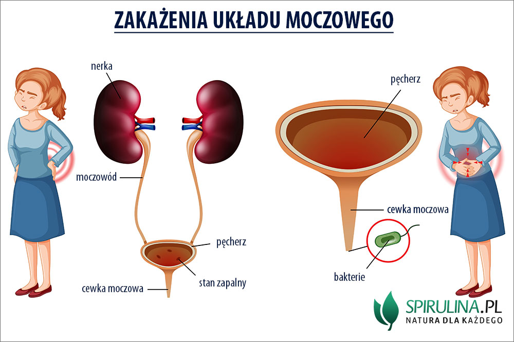 oduczanie pieluchy infekcja układu moczowego